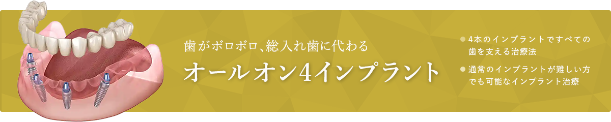 歯がボロボロ、総入れ歯に代わるオールオン4インプラント