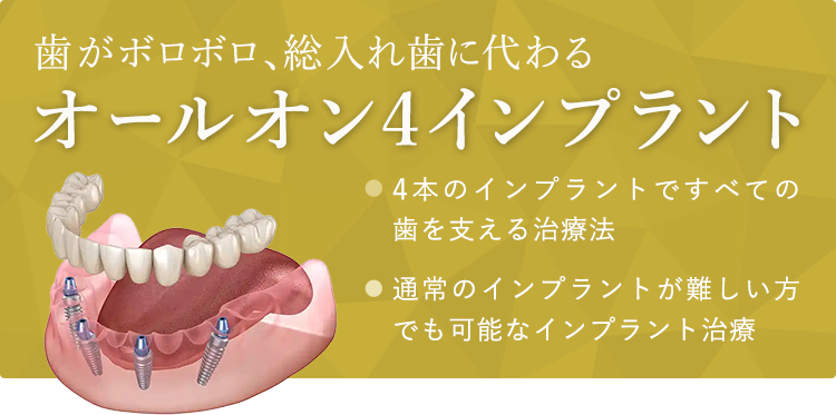 歯がボロボロ、総入れ歯に代わるオールオン4インプラント